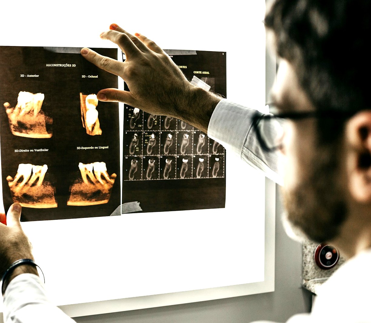 Dentist reviewing tooth X-rays before implant treatment